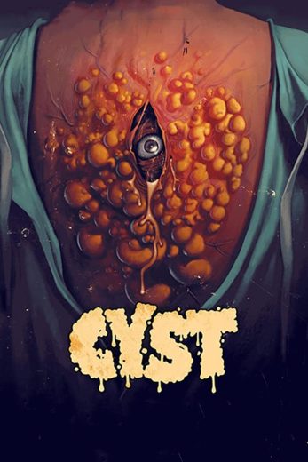 Cyst (2021)
